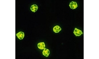 Ac anti-cytoplasme des polynucléaires neutrophiles (ANCA)